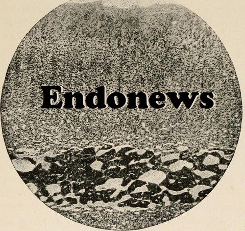 Эндоновости