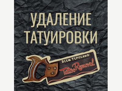Удаление тату  Казань
