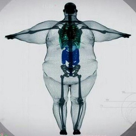 Записки жиробаса