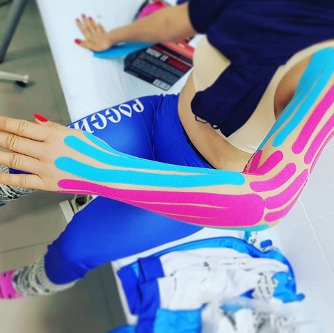 Кинезиотейпирование